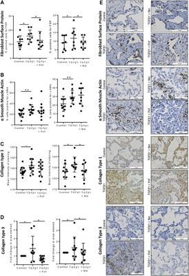 Evaluation of Pirfenidone and Nintedanib in a Human Lung Model of Fibrogenesis